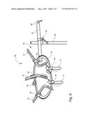 SURGICAL RETRACTOR WITH LIGHT diagram and image