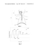 NEURAL MONITORING METHODS AND SYSTEMS FOR TREATING UPPER AIRWAY DISORDERS diagram and image