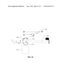 NEURAL MONITORING METHODS AND SYSTEMS FOR TREATING UPPER AIRWAY DISORDERS diagram and image