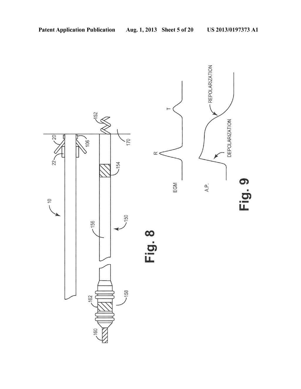 IMPLANTABLE MEDICAL DEVICE HAVING OPTICAL FIBER FOR SENSING ELECTRICAL     ACTIVITY - diagram, schematic, and image 06