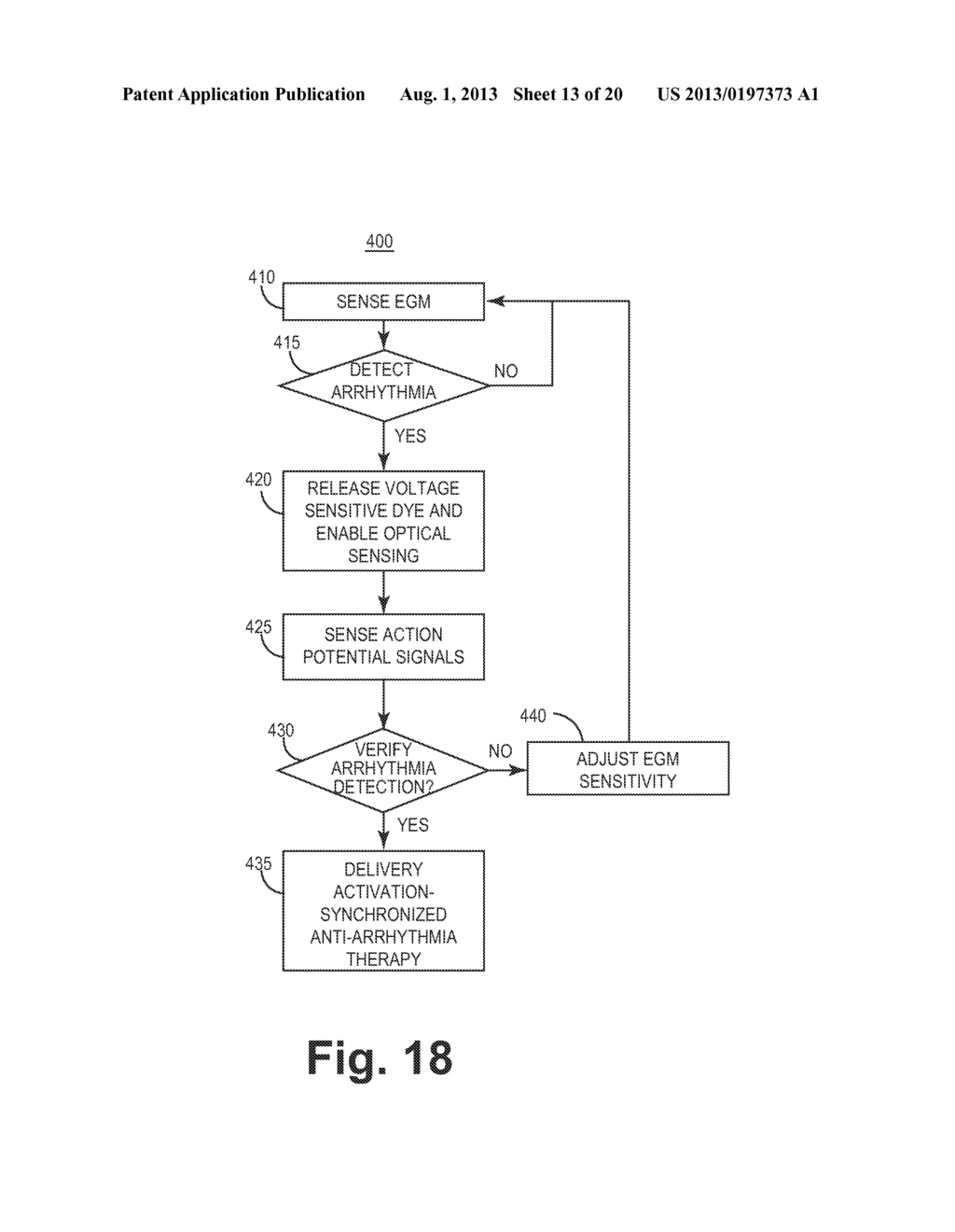 IMPLANTABLE MEDICAL DEVICE HAVING OPTICAL FIBER FOR SENSING ELECTRICAL     ACTIVITY - diagram, schematic, and image 14