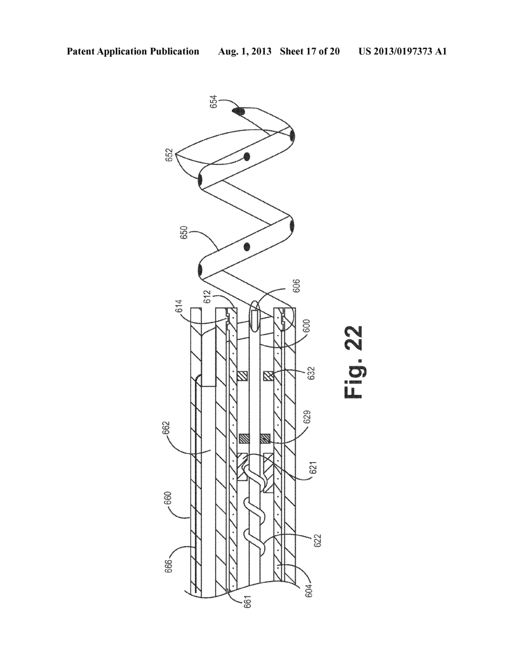 IMPLANTABLE MEDICAL DEVICE HAVING OPTICAL FIBER FOR SENSING ELECTRICAL     ACTIVITY - diagram, schematic, and image 18