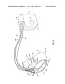 AUTOMATIC SELECTION OF ELECTRODE VECTORS FOR ASSESSING RISK OF HEART     FAILURE DECOMPENSATION EVENTS diagram and image