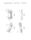 BRACE FOR CORRECTING CLUBFOOT diagram and image