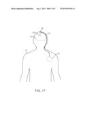 LEAD AND METHODS FOR BRAIN MONITORING AND MODULATION diagram and image