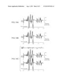 LEAD AND METHODS FOR BRAIN MONITORING AND MODULATION diagram and image