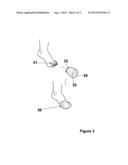 Oil Resistant Polymer Device, Method and Kit for Treating Fungal Infected     Nail diagram and image