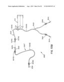 FLUID MANAGEMENT SYSTEM diagram and image