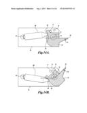 OCULAR LENS CAPSULE RETAINER diagram and image