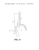 FLEXIBLE ENDOSCOPIC SURGICAL INSTRUMENT FOR INVAGINATION AND     FUNDOPLICATION diagram and image