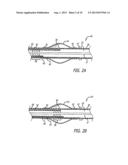 LONG NOSE MANIPULATABLE CATHETER diagram and image