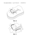 Wound Closure Device diagram and image