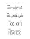 Bone Plate diagram and image