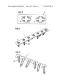 Bone Plate diagram and image