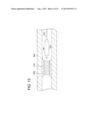 INDWELLING DEVICE DELIVERY SYSTEM diagram and image