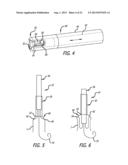 Inversion Delivery Device And Method For A Prosthesis diagram and image