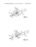 Inversion Delivery Device And Method For A Prosthesis diagram and image