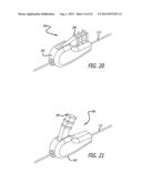 Inversion Delivery Device And Method For A Prosthesis diagram and image