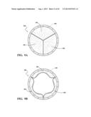 DURABLE MULTI-LAYER HIGH STRENGTH POLYMER COMPOSITE SUITABLE FOR IMPLANT     AND ARTICLES PRODUCED THEREFROM diagram and image