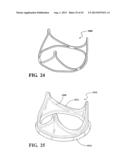 DURABLE MULTI-LAYER HIGH STRENGTH POLYMER COMPOSITE SUITABLE FOR IMPLANT     AND ARTICLES PRODUCED THEREFROM diagram and image