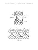 DURABLE MULTI-LAYER HIGH STRENGTH POLYMER COMPOSITE SUITABLE FOR IMPLANT     AND ARTICLES PRODUCED THEREFROM diagram and image