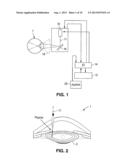 APPARATUS FOR PATTERNED PLASMA-MEDIATED LASER TREPHINATION OF THE LENS     CAPSULE AND THREE DIMENSIONAL PHACO-SEGMENTATION diagram and image