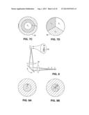 APPARATUS FOR PATTERNED PLASMA-MEDIATED LASER TREPHINATION OF THE LENS     CAPSULE AND THREE DIMENSIONAL PHACO-SEGMENTATION diagram and image