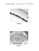 APPARATUS FOR PATTERNED PLASMA-MEDIATED LASER TREPHINATION OF THE LENS     CAPSULE AND THREE DIMENSIONAL PHACO-SEGMENTATION diagram and image