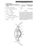 INTRAOCULAR LENS IMPLANT diagram and image