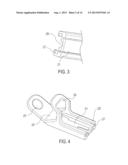 LAMINOPLASTY IMPLANT, METHOD AND INSTRUMENTATION diagram and image