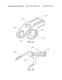 LAMINOPLASTY IMPLANT, METHOD AND INSTRUMENTATION diagram and image