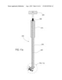 LAMINOPLASTY IMPLANT, METHOD AND INSTRUMENTATION diagram and image