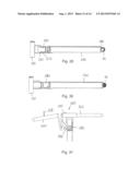 SYSTEMS AND METHODS FOR FACET JOINT TREATMENT diagram and image