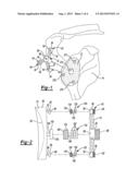 CONVERTIBLE GLENOID IMPLANT diagram and image