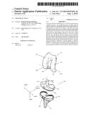 PROSTHETIC JOINT diagram and image