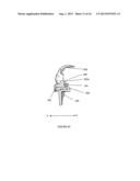 PROSTHETIC JOINT diagram and image