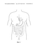 MUCOSAL TISSUE ADHESION VIA TEXTURED SURFACE diagram and image