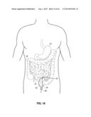 MUCOSAL TISSUE ADHESION VIA TEXTURED SURFACE diagram and image