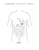 MUCOSAL TISSUE ADHESION VIA TEXTURED SURFACE diagram and image