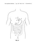 MUCOSAL TISSUE ADHESION VIA TEXTURED SURFACE diagram and image