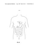 MUCOSAL TISSUE ADHESION VIA TEXTURED SURFACE diagram and image