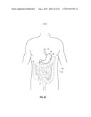 MUCOSAL TISSUE ADHESION VIA TEXTURED SURFACE diagram and image