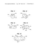 METHODS AND DEVICES FOR PREPARING AND IMPLANTING TISSUE SCAFFOLDS diagram and image