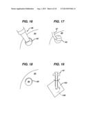 METHODS AND DEVICES FOR PREPARING AND IMPLANTING TISSUE SCAFFOLDS diagram and image