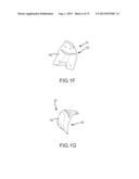 SYSTEM AND METHOD FOR IMAGE SEGMENTATION IN GENERATING COMPUTER MODELS OF     A JOINT TO UNDERGO ARTHROPLASTY diagram and image