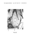 SYSTEM AND METHOD FOR IMAGE SEGMENTATION IN GENERATING COMPUTER MODELS OF     A JOINT TO UNDERGO ARTHROPLASTY diagram and image