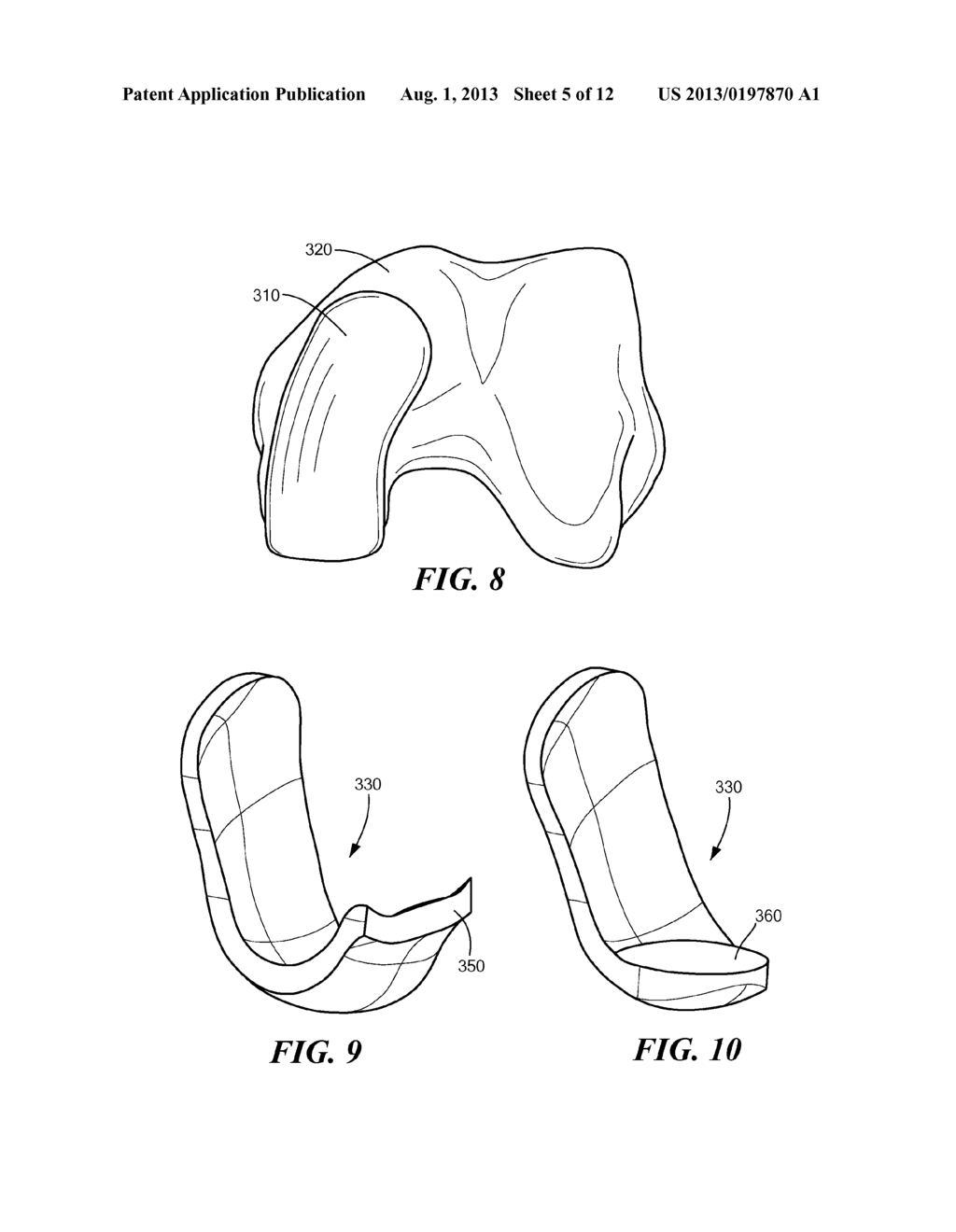 Automated Systems for Manufacturing Patient-Specific Orthopedic Implants     and Instrumentation - diagram, schematic, and image 06