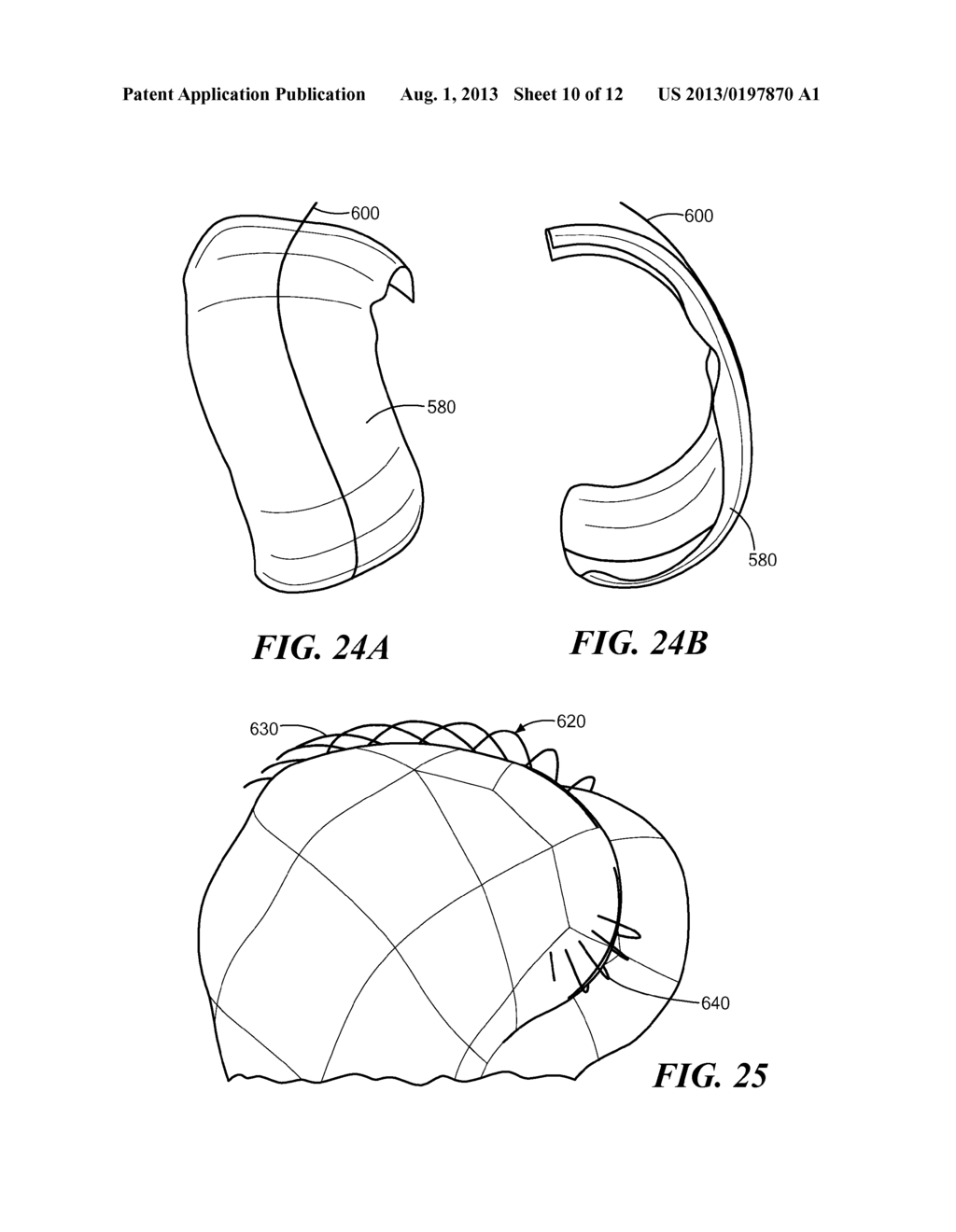 Automated Systems for Manufacturing Patient-Specific Orthopedic Implants     and Instrumentation - diagram, schematic, and image 11