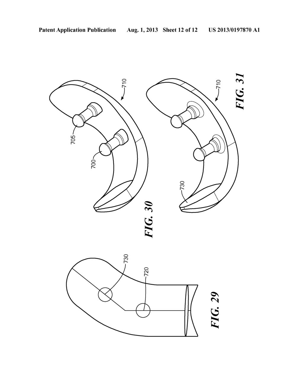 Automated Systems for Manufacturing Patient-Specific Orthopedic Implants     and Instrumentation - diagram, schematic, and image 13