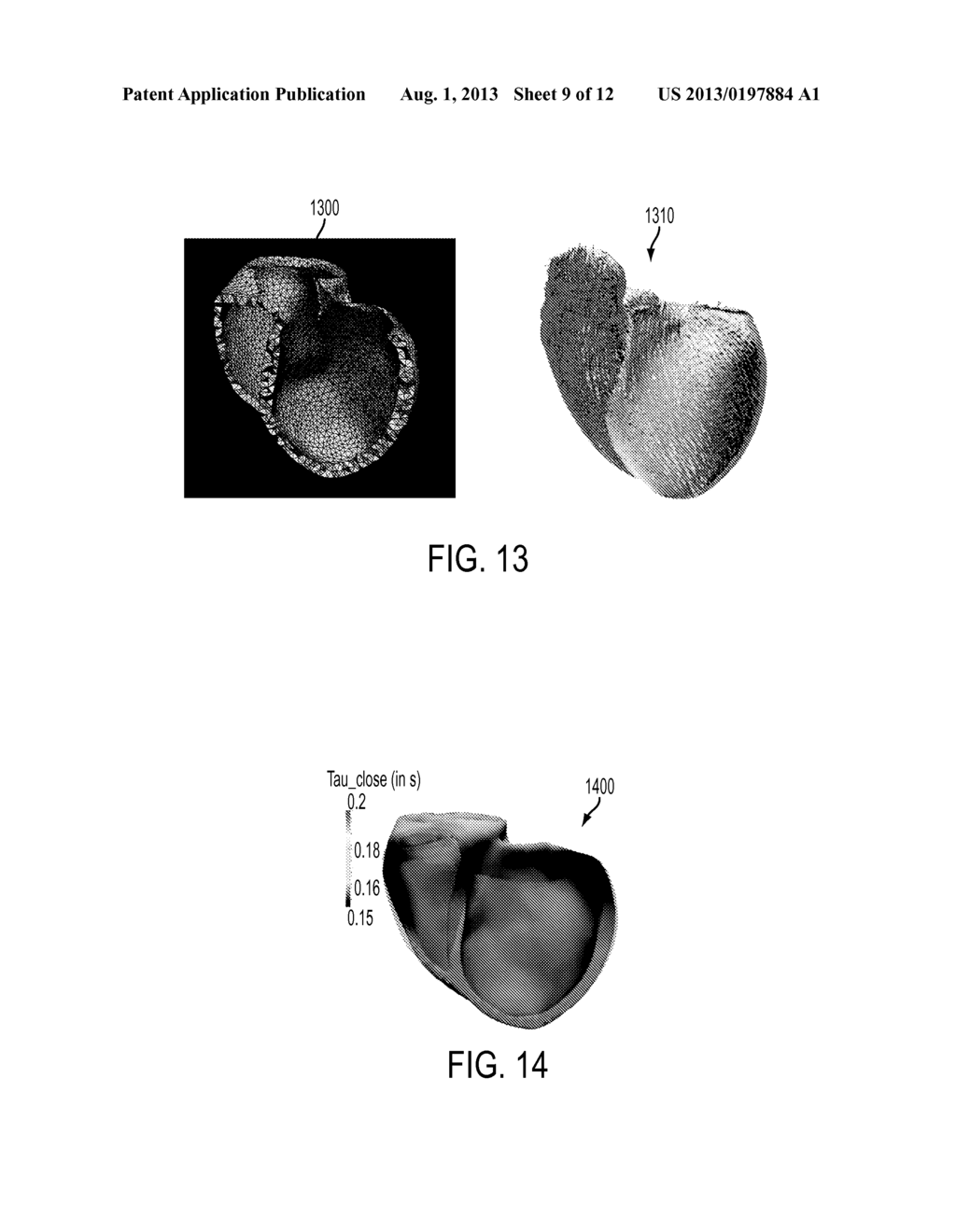 Method and System for Advanced Measurements Computation and Therapy     Planning from Medical Data and Images Using a Multi-Physics Fluid-Solid     Heart Model - diagram, schematic, and image 10